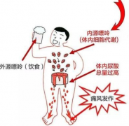 体检中尿酸值高怎么办？成都降尿酸治疗痛风哪里好？