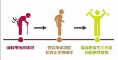 强直性脊柱炎患者如何正常过夫妻生活？成都治疗强直医