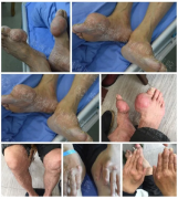 痛风风湿骨病患者注意：本周末，德国与国内三甲名医在