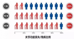 关节反复痛注意！京沪川三甲名医联合英国皇家学院博士