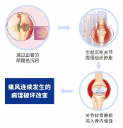 肌骨超声，让痛看得见