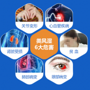 类风湿性关节炎危害大，不容小觑